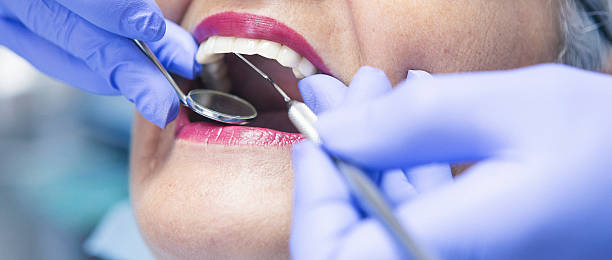 Best Pediatric Emergency Dentist in Granite Bay, CA